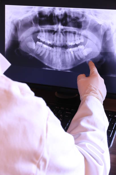Best Emergency Root Canal Treatment in Norwood, PA